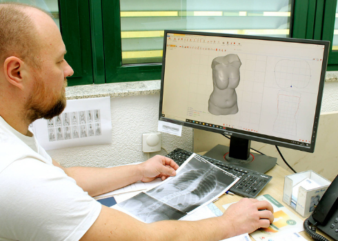 3D dizajn ortoza za skoliozu